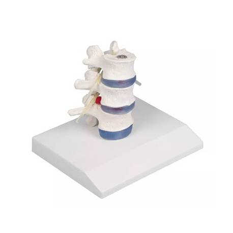 DEMO LUMBAR VERTERBAE ON TRIPOD