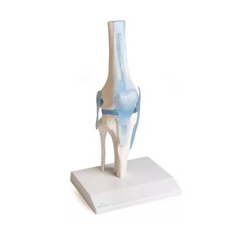 DEMO KNIE OP STATIEF